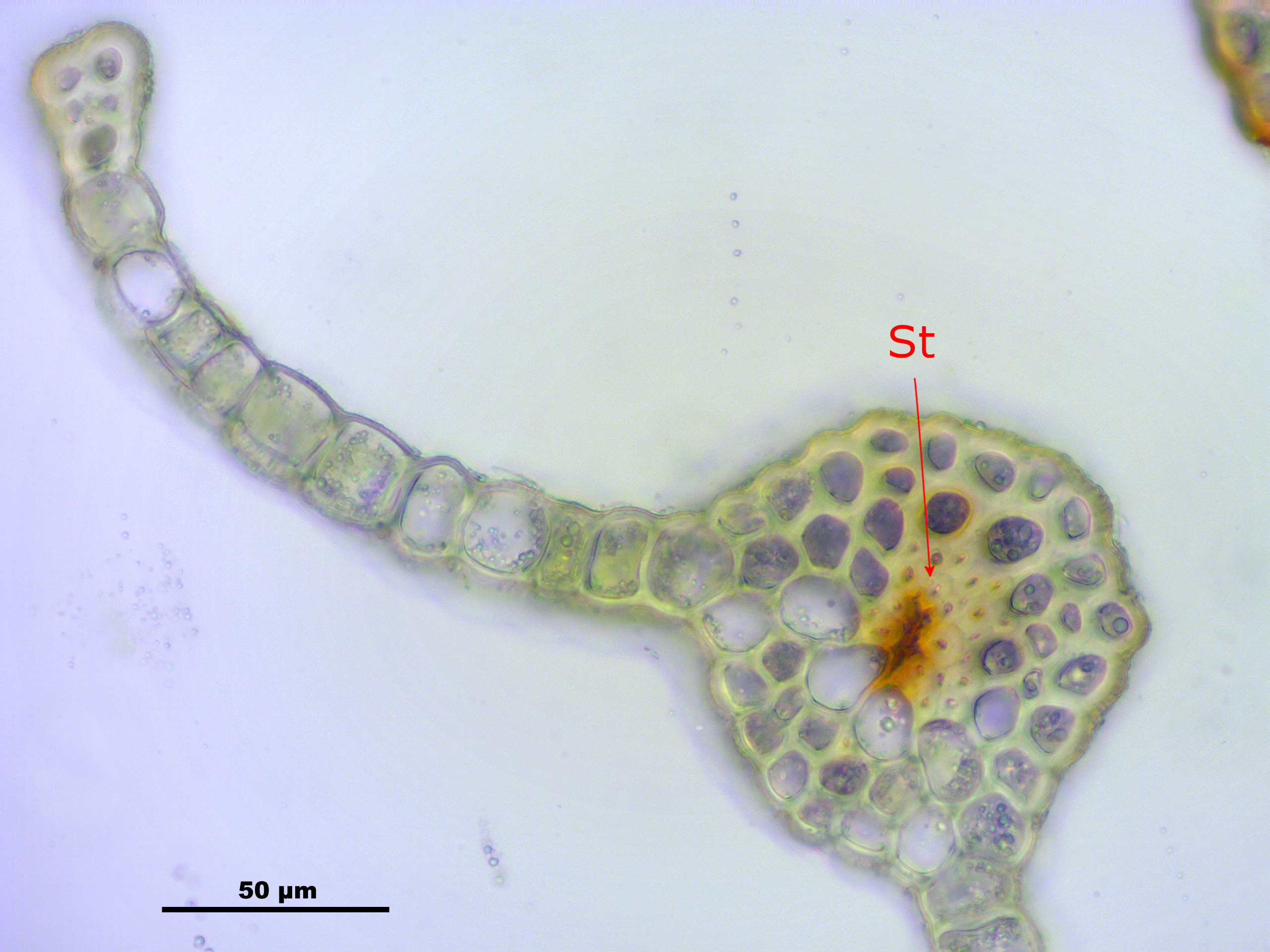 Mnium_lycopodioides_%28a,_144805-474432%29_7931with%20markings